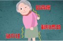 茄子视频官网APP下载茄子视频治療儀老年人骨質疏鬆的治療方法,如何預防骨質疏鬆症