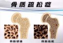 國產茄子视频官网APP下载茄子视频儀器有效預防骨質疏鬆症依賴於定期的茄子视频官网APP下载茄子视频測試